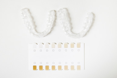 two dental whitening trays and a palette for tooth color